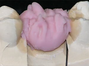 A2-BODY-PORCELAIN-LAYERED-OVER-A2-OPACIOUS-BODY-&-LUSTER-MIX