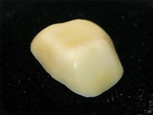 COPING-WITH-SHADE-BASED-STAIN-APPLIED-build-up-1