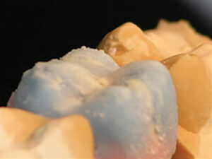 E2-ENAMEL-LAYERED-OVER-TX-TRANSLUCENT-&-A2-BODY