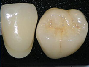 LUSTER-LTO-LAYERED-OVER-ENTIRE-BUILD-UP-Build-up-1