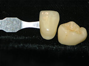 LUSTER-LTO-LAYERED-OVER-ENTIRE-BUILD-UP-Build-up-2