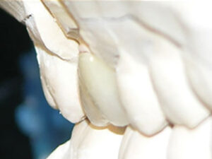 LUSTER-LTO-LAYERED-OVER-ENTIRE-BUILD-UP-Build-up-3