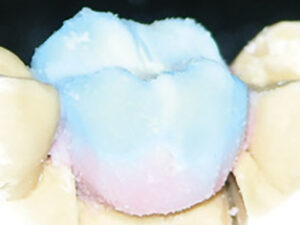 LUSTER-LTO-LAYERED-OVER-ENTIRE-BUILD-UP-Build-up-4