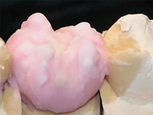 TX-TRANSLUCENT-LAYERED-ON-BODY-A2